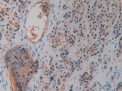 Polyclonal Antibody to Cluster Of Differentiation 26 (CD26)