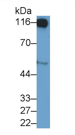 Polyclonal Antibody to Cluster Of Differentiation 26 (CD26)