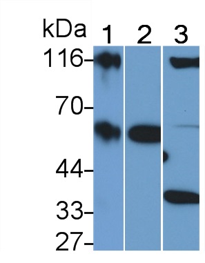 Polyclonal Antibody to Cluster Of Differentiation 26 (CD26)