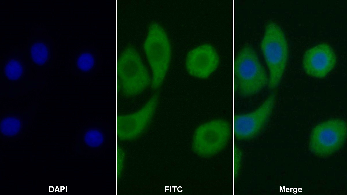 Polyclonal Antibody to Cluster Of Differentiation 26 (CD26)