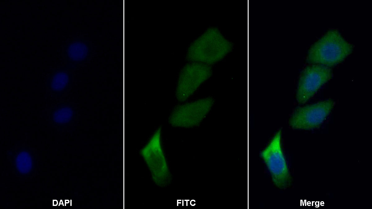 Polyclonal Antibody to Cluster Of Differentiation 26 (CD26)