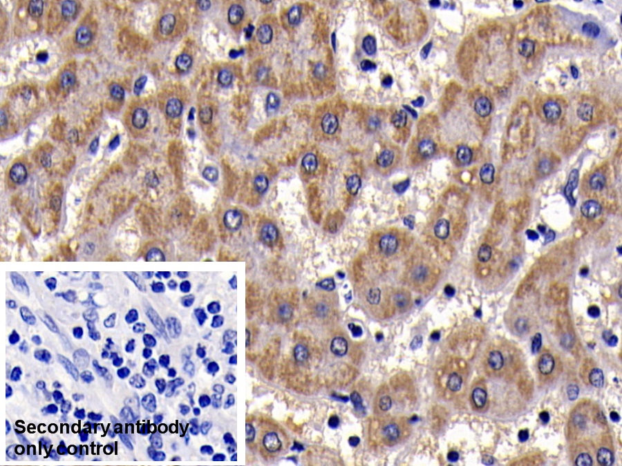 Polyclonal Antibody to Serum Amyloid A (SAA)