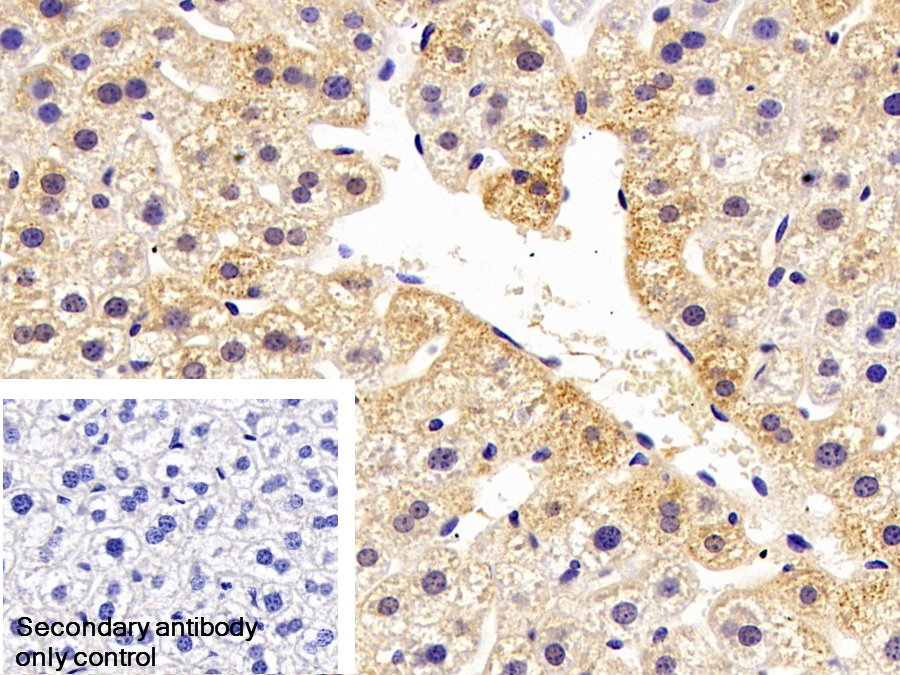 Polyclonal Antibody to Serum Amyloid A (SAA)