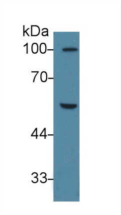 Polyclonal Antibody to Peroxisome Proliferator Activated Receptor Gamma (PPARg)