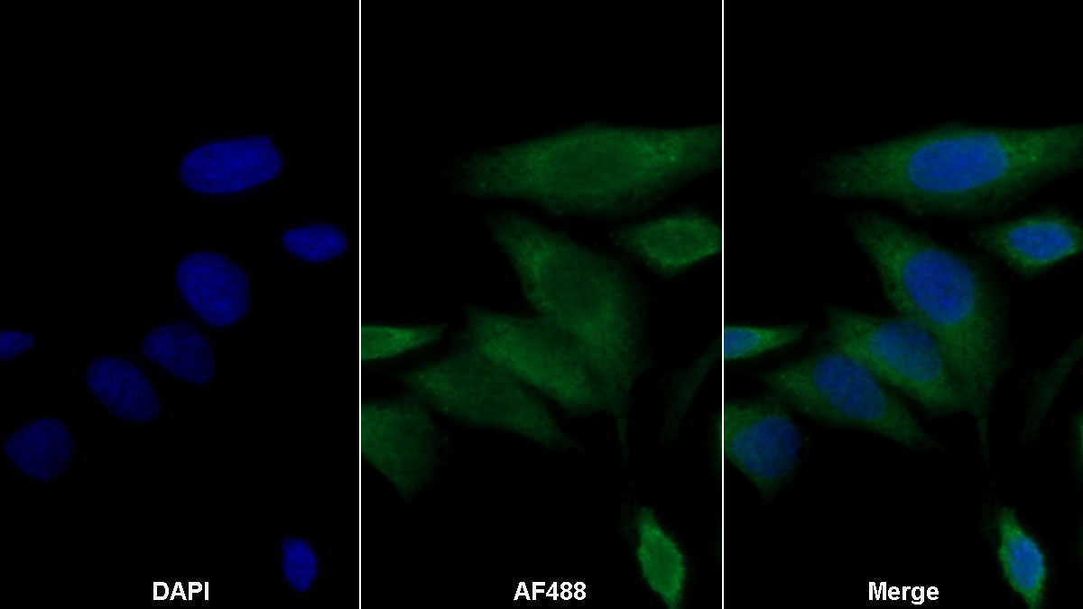 Polyclonal Antibody to Peroxisome Proliferator Activated Receptor Gamma (PPARg)