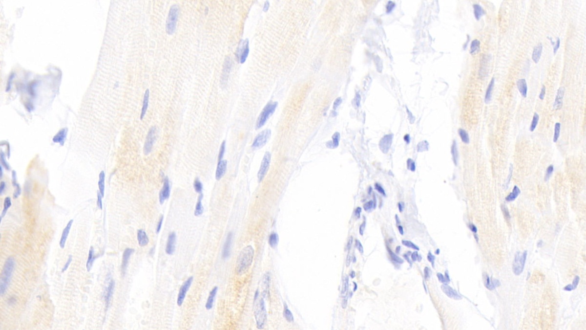 Polyclonal Antibody to Peroxisome Proliferator Activated Receptor Gamma (PPARg)