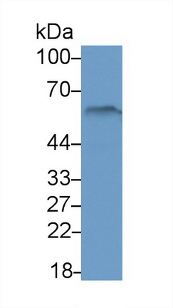 Polyclonal Antibody to Peroxisome Proliferator Activated Receptor Gamma (PPARg)