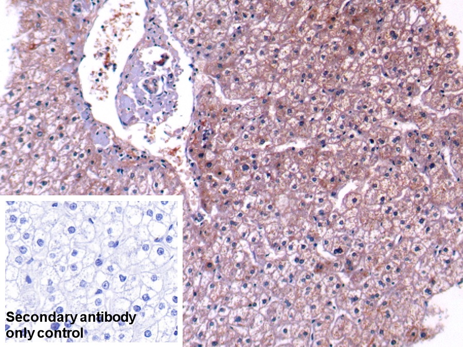 Polyclonal Antibody to Complement Component 4 (C4)