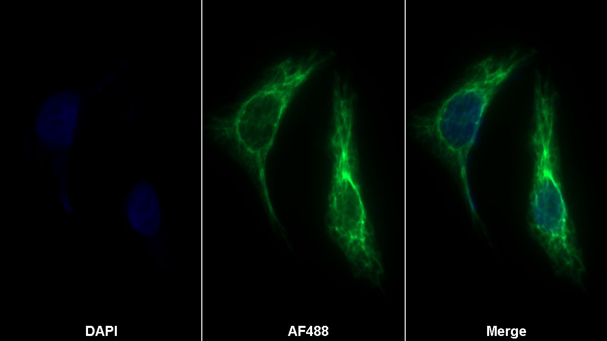 Polyclonal Antibody to Renin (REN)