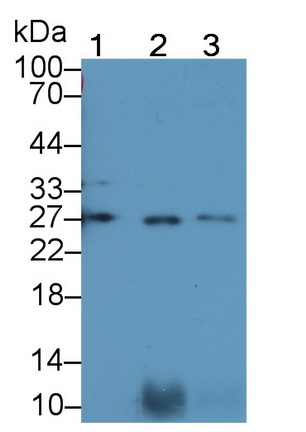 Polyclonal Antibody to Pulmonary Surfactant Associated Protein A1 (SFTPA1)