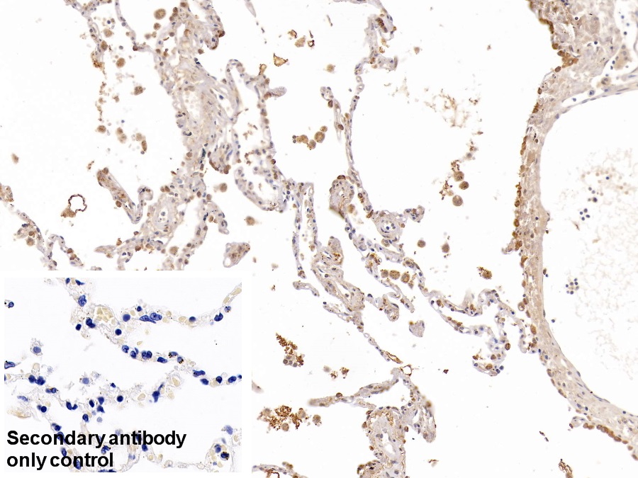 Polyclonal Antibody to Pulmonary Surfactant Associated Protein A1 (SFTPA1)