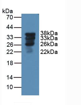 Polyclonal Antibody to Pulmonary Surfactant Associated Protein A1 (SFTPA1)