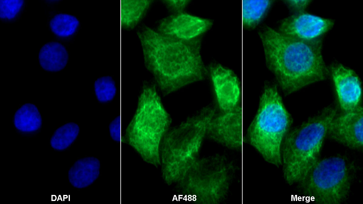 Polyclonal Antibody to Arachidonate-15-Lipoxygenase (ALOX15)