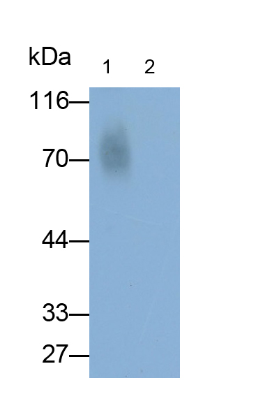 Polyclonal Antibody to Beta-Crosslaps (bCTx)