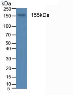 Polyclonal Antibody to Insulin Receptor (INSR)