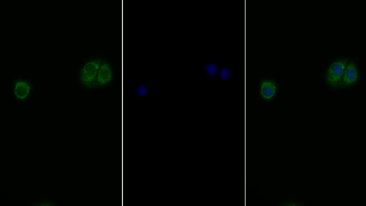 Polyclonal Antibody to Insulin Receptor (INSR)