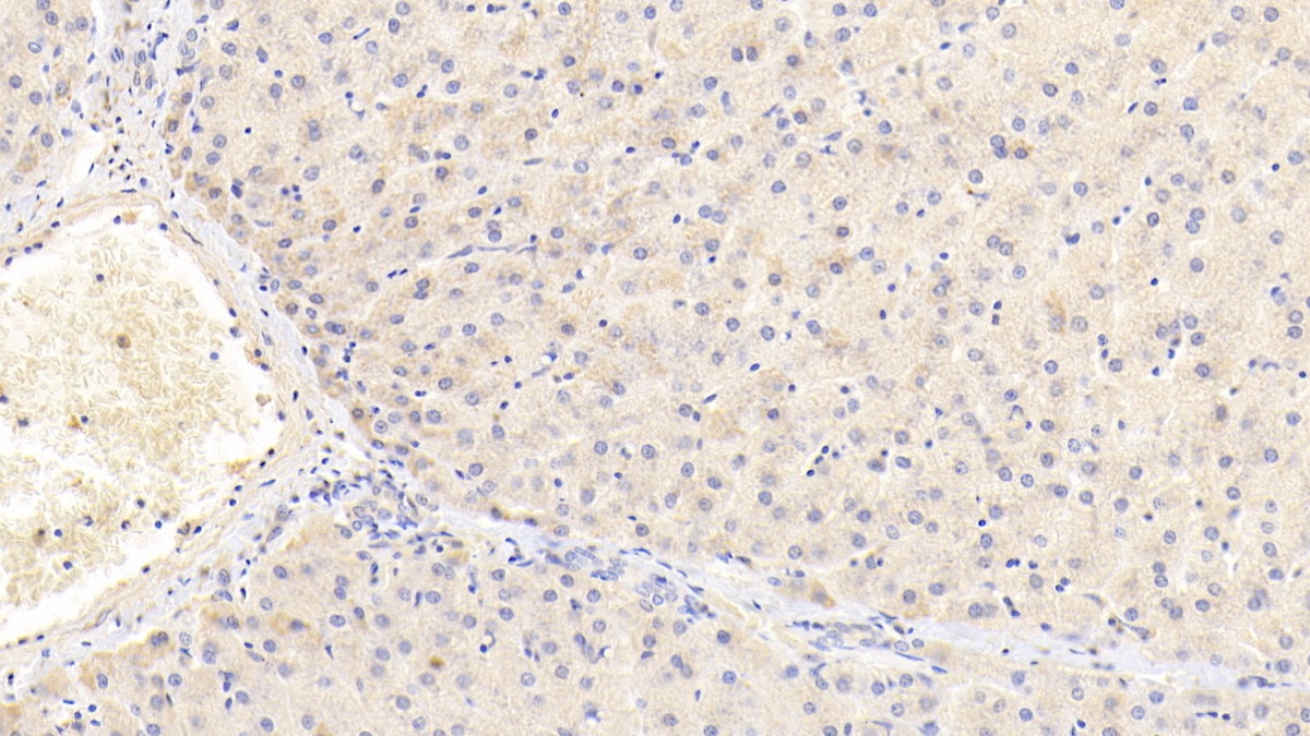 Polyclonal Antibody to Insulin Receptor (INSR)