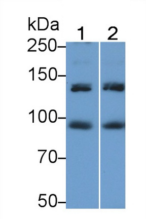 Polyclonal Antibody to Insulin Receptor (INSR)