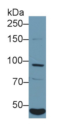 Polyclonal Antibody to Insulin Receptor (INSR)