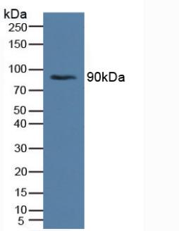 Polyclonal Antibody to Insulin Receptor (INSR)