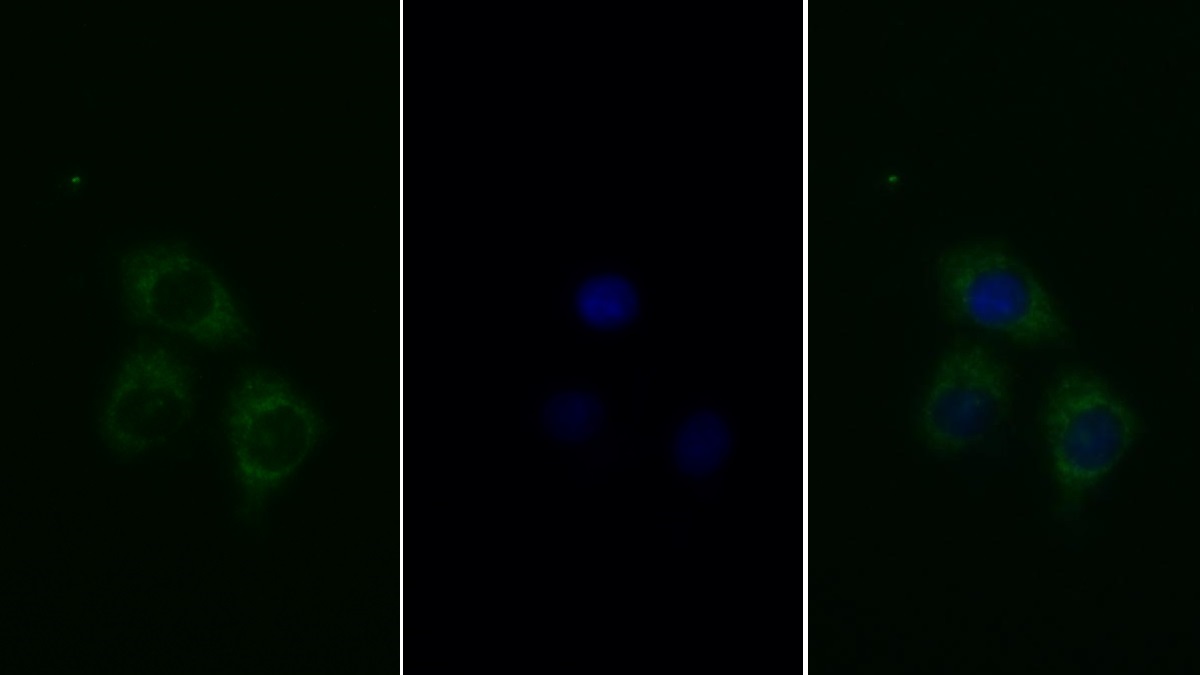 Polyclonal Antibody to Insulin Receptor (INSR)