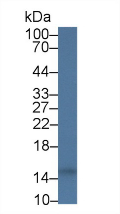 Polyclonal Antibody to Cystatin C (Cys-C)