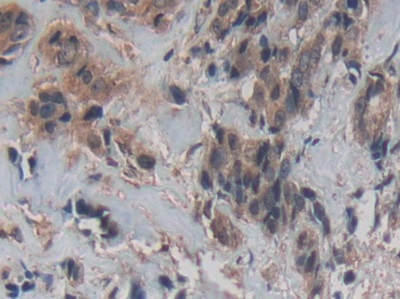 Polyclonal Antibody to Cystatin C (Cys-C)