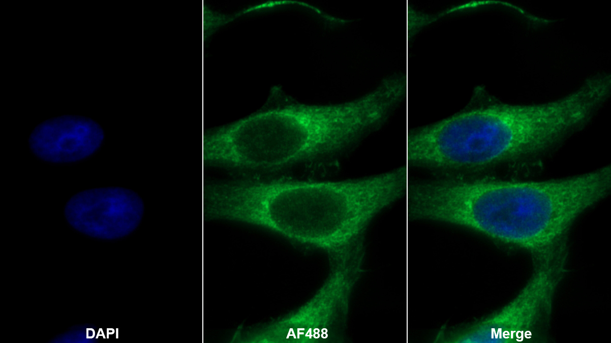 Polyclonal Antibody to Cystatin C (Cys-C)