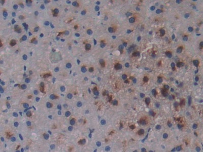 Polyclonal Antibody to Osteopontin (OPN)