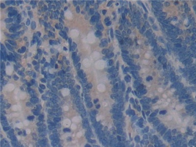 Polyclonal Antibody to Osteopontin (OPN)