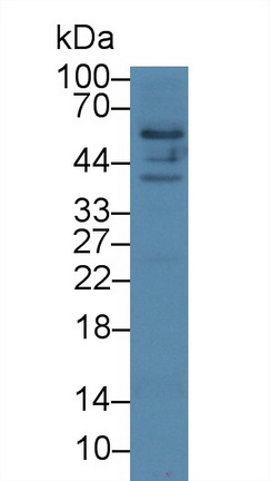 Polyclonal Antibody to Osteopontin (OPN)