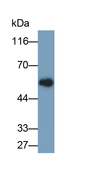 Polyclonal Antibody to Osteopontin (OPN)