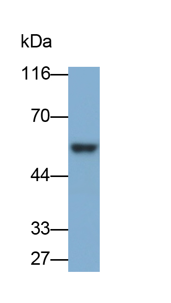 Polyclonal Antibody to Osteopontin (OPN)