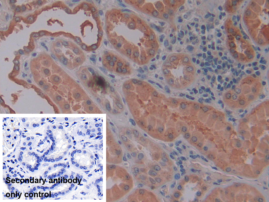 Polyclonal Antibody to Osteopontin (OPN)