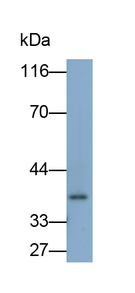 Polyclonal Antibody to Acid Phosphatase 5, Tartrate Resistant (ACP5)