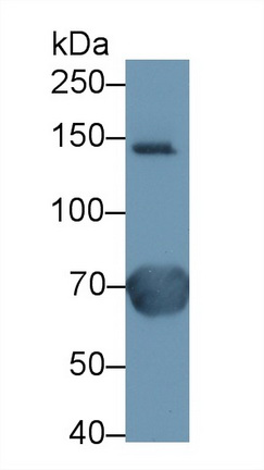 Polyclonal Antibody to Ceruloplasmin (CP)