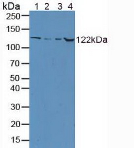 Polyclonal Antibody to Ceruloplasmin (CP)