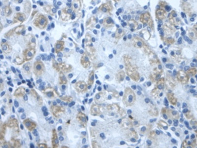 Polyclonal Antibody to Dihydrolipoyl Dehydrogenase (DLD)