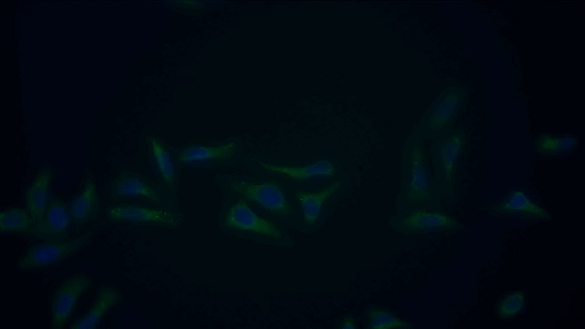 Polyclonal Antibody to Dihydrolipoyl Dehydrogenase (DLD)