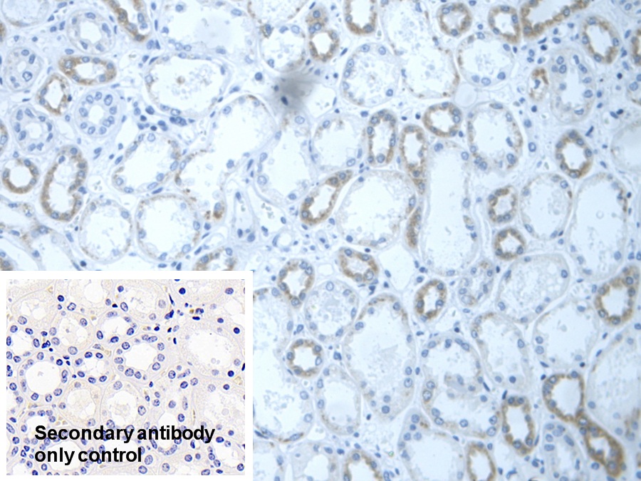 Polyclonal Antibody to Dihydrolipoyl Dehydrogenase (DLD)