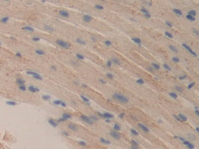 Polyclonal Antibody to Dihydrolipoyl Dehydrogenase (DLD)