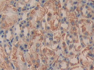 Polyclonal Antibody to Dihydrolipoyl Dehydrogenase (DLD)