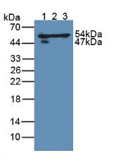 Polyclonal Antibody to Dihydrolipoyl Dehydrogenase (DLD)