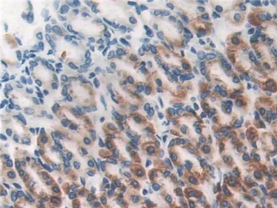 Polyclonal Antibody to Dihydrolipoyl Dehydrogenase (DLD)