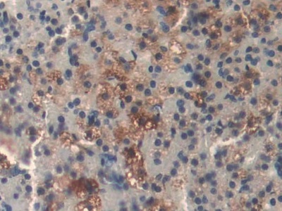 Polyclonal Antibody to Dihydrolipoyl Dehydrogenase (DLD)