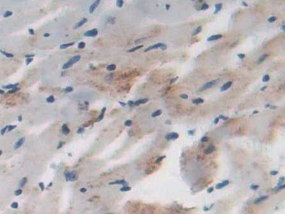 Polyclonal Antibody to Dihydrolipoyl Dehydrogenase (DLD)