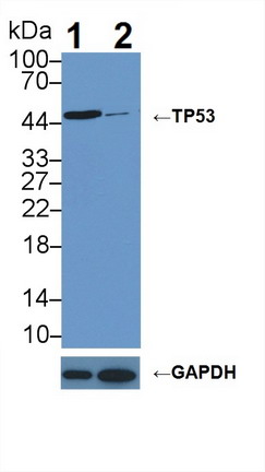 Polyclonal Antibody to Tumor Protein p53 (P53)