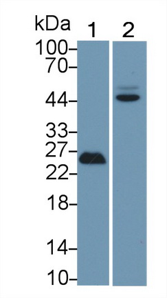 Polyclonal Antibody to Tumor Protein p53 (P53)