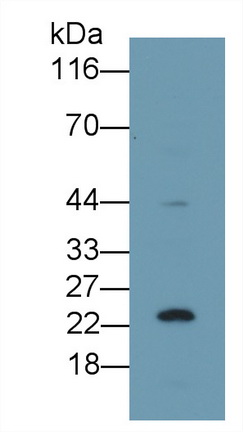 Polyclonal Antibody to Tumor Protein p53 (P53)