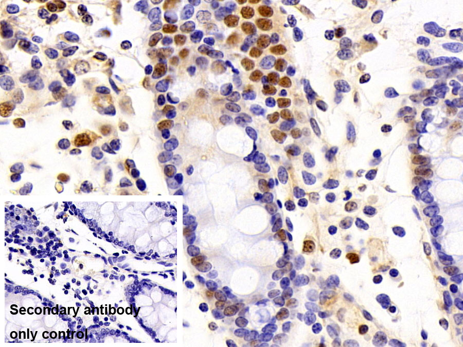 Polyclonal Antibody to Tumor Protein p53 (P53)